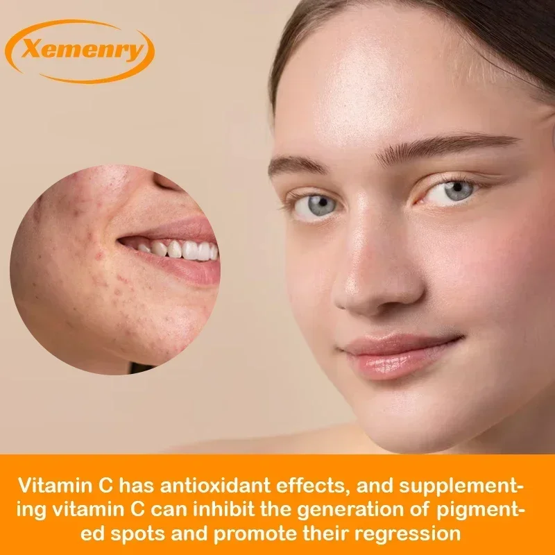 Vitamin C Capsules 1000mg - Im - Zinc Supplement 50Mg ulasan dan harga